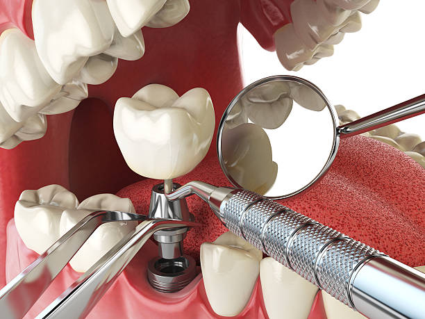 Best Cracked Tooth Emergency Dentist  in Dundee, MI